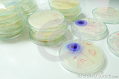 Microbiology laboratory test Stock Photo