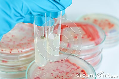 Microbiology laboratory test Stock Photo