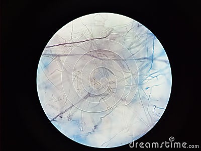 Microbiology Mycology mold Isolate from banana leave KMUTT Thailand Stock Photo