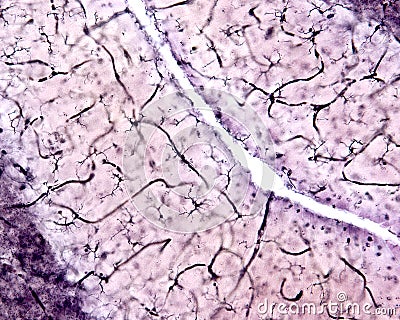 Microglia. Cerebellar cortex Stock Photo