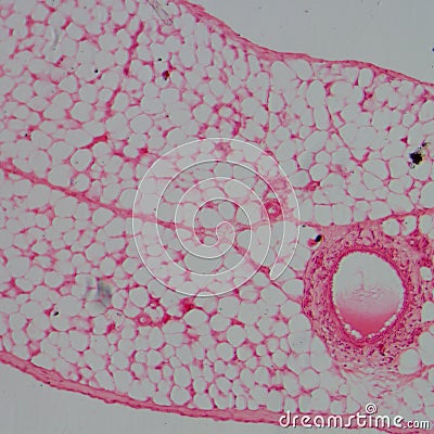 Micrograph of blood vessel, artery Stock Photo