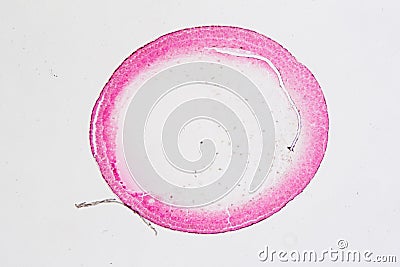 Micrograph cleavage stage of frog egg Stock Photo