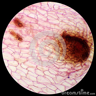 Micrograph of new sporophyte of fern leaf prothallium, background Stock Photo