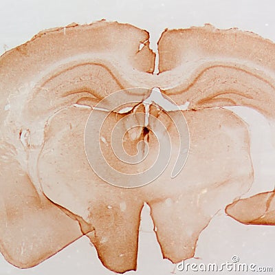 Micrograph of rat brain Stock Photo