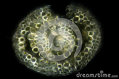 Micrograph of a seta cross section in Polytrichum moss. Stock Photo