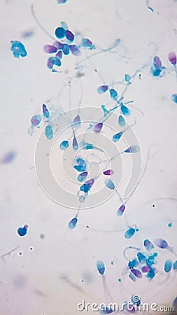 microphotography show test acrosomal integrity in human semen Stock Photo