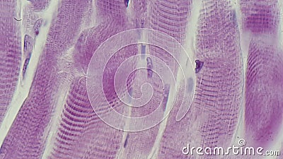 Microphotography striated muscle Stock Photo