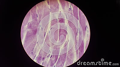 Microphotography striated muscle Stock Photo
