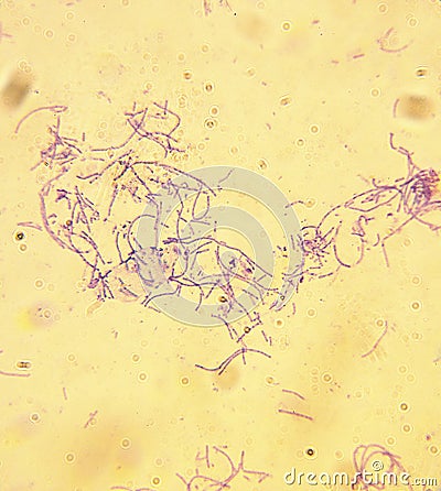 Microscope-Anthrax-Bacillus anthracis Stock Photo