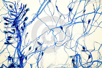 Microscope of black fungus spore strain with Lactophenol cotton blue, molds or yeasts with macro 40x lens, contamination in air Stock Photo