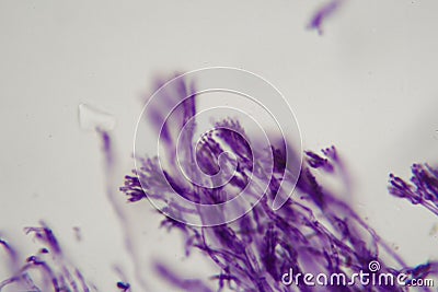 Microscope photo a bundle of Penicillium fungi Stock Photo