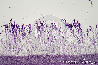 Microscope photo a bundle of Penicillium fungi Stock Photo