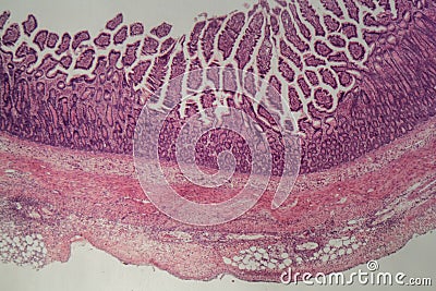 Microscope photo of a large intestine section with inflammation Colitis Stock Photo