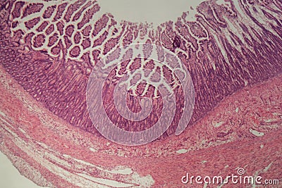 Microscope photo of a large intestine section with inflammation Colitis Stock Photo