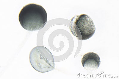 Microscope photography of Rhizopus Stock Photo