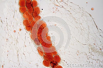 Microscope view of adipose tissue Stock Photo