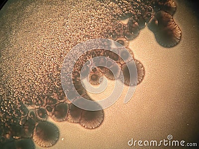 Microscope view of a bacterial colonies and Candida albicans Stock Photo