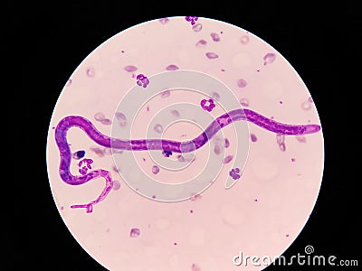 Microscopic examination of stained blood films used to differentiate microfilariae. Stock Photo