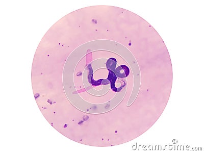 Microscopic examination of stained blood films used to differentiate microfilariae. Stock Photo