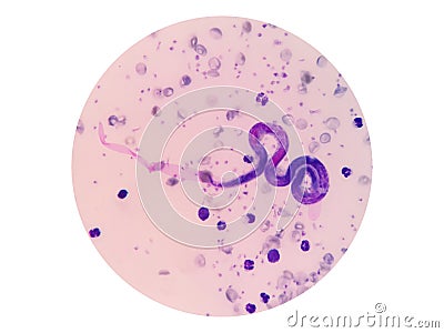 Microscopic examination of stained blood films used to differentiate microfilariae. Stock Photo