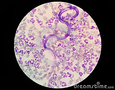 Microscopic examination of stained blood films used to differentiate microfilariae. Stock Photo