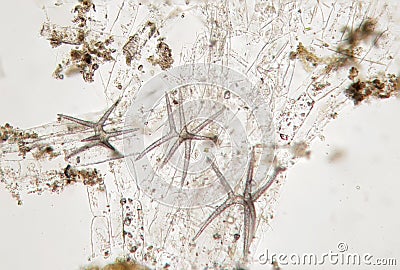 Microscopic life, spiked algae hedgehog, probably diatom algae. Freshwater phytoplankton by microscope Stock Photo