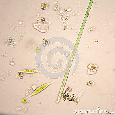 Oscillatoria simplicissima and Euglena Gracilis Stock Photo