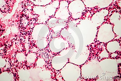 Microscopic photo showing lung tissue Stock Photo