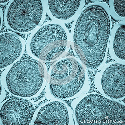 Microscopic section of Testis T. S Stock Photo