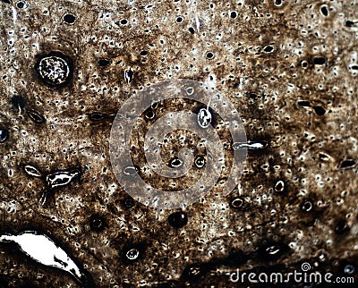 Microscopic section x100 of compact bone. Stock Photo