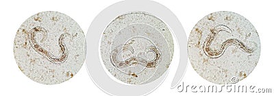 Microscopic view collection of adult free-living female Strongyloides stercoralis, a human pathogenic parasitic roundworm causing Stock Photo