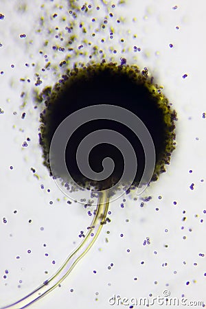 Microscopic view of a conidial head of Black mold (Aspergillus niger) with spores Stock Photo