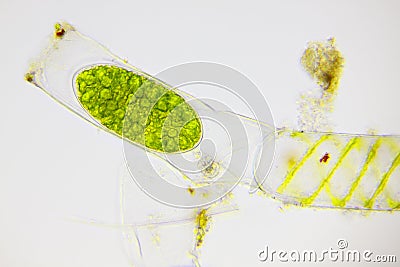 Microscopic view of freshwater green algae (Spirogyra) filament with young zygospore Stock Photo