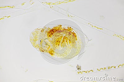 Microscopic view of planktonic wheel animal rotifer Stock Photo