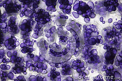 Microscopic view of a potato starch in potato tuber cells Stock Photo