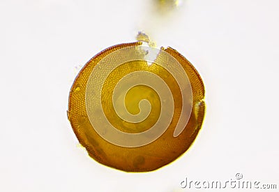 Microscopic view of testate amoeba Arcella shell with visible some of internal structure Stock Photo