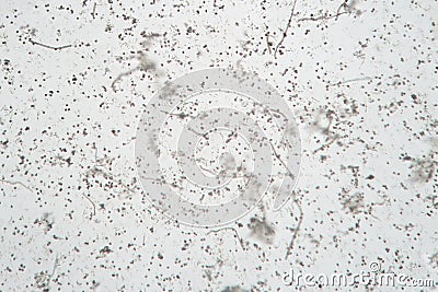 Microscopic volatile spores of puffball fungus. Lycoperdon, Basidiomycota Stock Photo