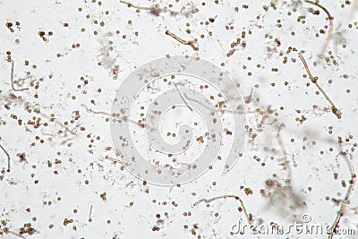 Microscopic volatile spores of puffball fungus. Lycoperdon, Basidiomycota is a genus of puffball mushrooms Stock Photo