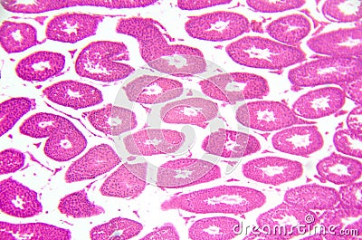 Microscopy photography. Testis, seminiferous tubules, cross sect Stock Photo