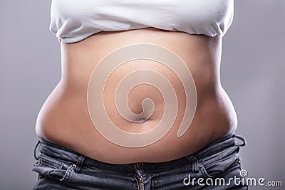 Woman With Excessive Belly Fat Stock Photo