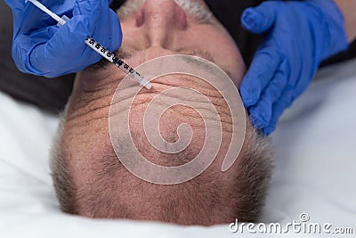 Middle aged caucasian man getting a wrinkle treatment on forehead Stock Photo