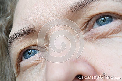 Middle aged female`s eye with drooping eyelid. Ptosis is a drooping of the upper eyelid, lazy eye. Cosmetology and facial concept Stock Photo