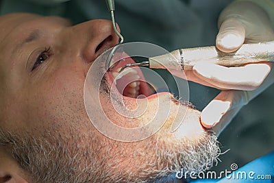 A middle aged man at the dental clinic the dentist checke his teeth Stock Photo