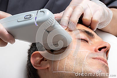 Middle aged man having skin tightening ultrasound facial treatment Stock Photo