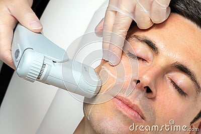 Middle aged man having skin tightening ultrasound treatment on cheek Stock Photo