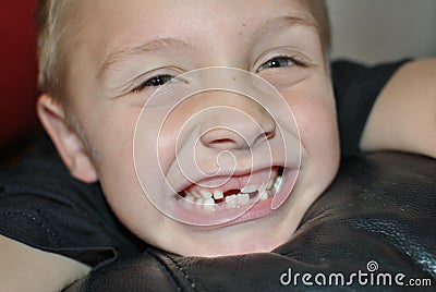 Milk teeth Stock Photo