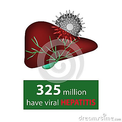 325 million have viral hepatitis. Liver and hepatitis virus. World Hepatitis Day. Infographics. Vector Vector Illustration