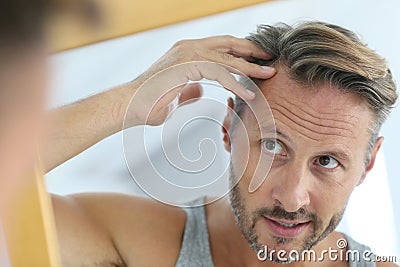 Mirror portrait of man concerned by hair loss Stock Photo