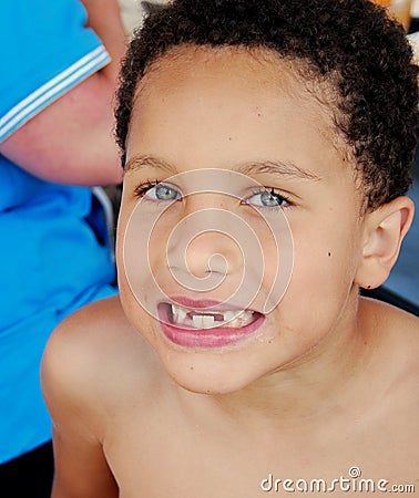 Missing Teeth Stock Photo