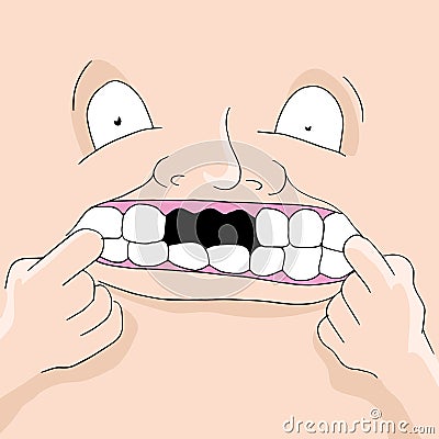 Missing Teeth Vector Illustration